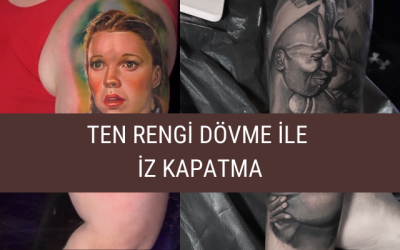Ten Rengi Dövme ile İz Kapatma
